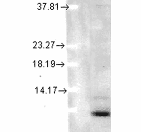Western Blot - Anti-Ubiquitin Antibody [5B9-B3] (A305078) - Antibodies.com