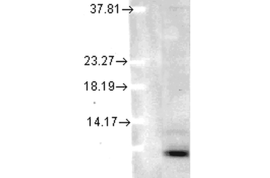 Western Blot - Anti-Ubiquitin Antibody [5B9-B3] (A305078) - Antibodies.com