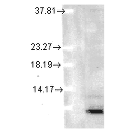 Western Blot - Anti-Ubiquitin Antibody [5B9-B3] (A305078) - Antibodies.com