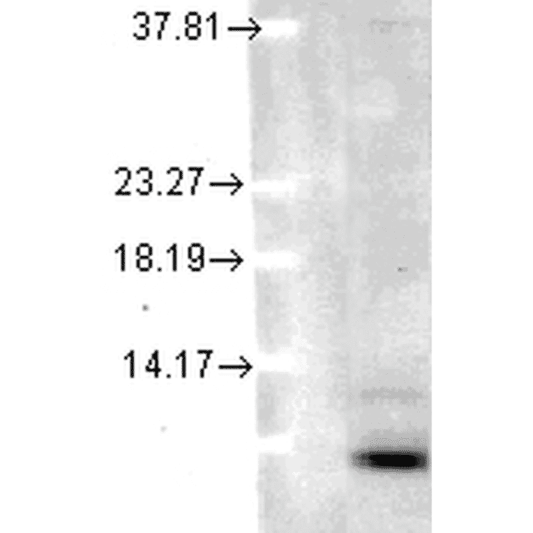 Western Blot - Anti-Ubiquitin Antibody [5B9-B3] (A305078) - Antibodies.com
