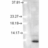 Western Blot - Anti-Ubiquitin Antibody [5B9-B3] (A305078) - Antibodies.com