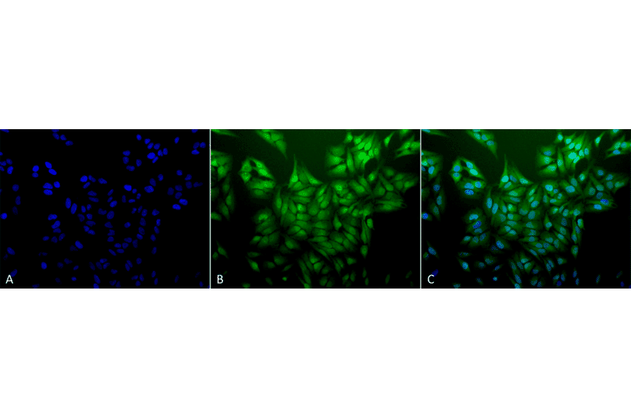 Immunocytochemistry/Immunofluorescence - Anti-Ubiquitin Antibody [5B9-B3] (A305078) - Antibodies.com