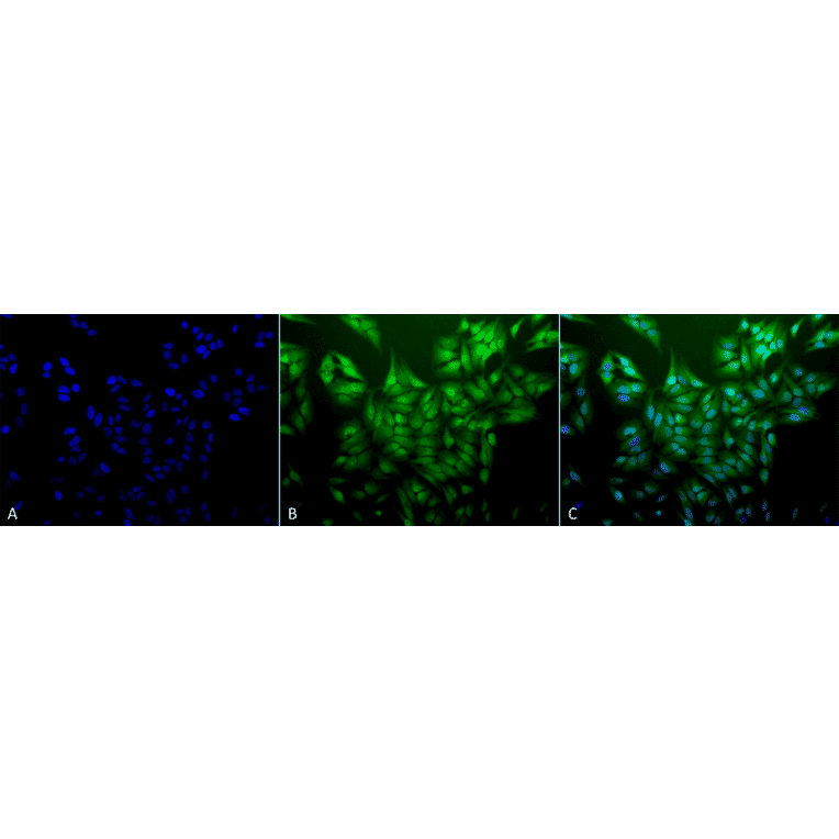Immunocytochemistry/Immunofluorescence - Anti-Ubiquitin Antibody [5B9-B3] (A305078) - Antibodies.com
