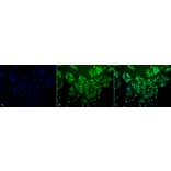 Immunocytochemistry/Immunofluorescence - Anti-Ubiquitin Antibody [5B9-B3] (A305078) - Antibodies.com