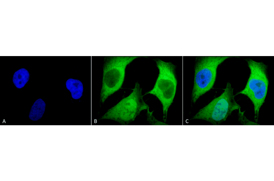 Immunocytochemistry/Immunofluorescence - Anti-Ubiquitin Antibody [5B9-B3] (A305078) - Antibodies.com