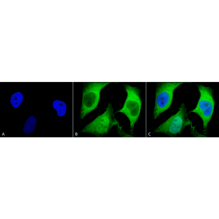 Immunocytochemistry/Immunofluorescence - Anti-Ubiquitin Antibody [5B9-B3] (A305078) - Antibodies.com