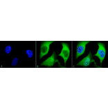 Immunocytochemistry/Immunofluorescence - Anti-Ubiquitin Antibody [5B9-B3] (A305078) - Antibodies.com