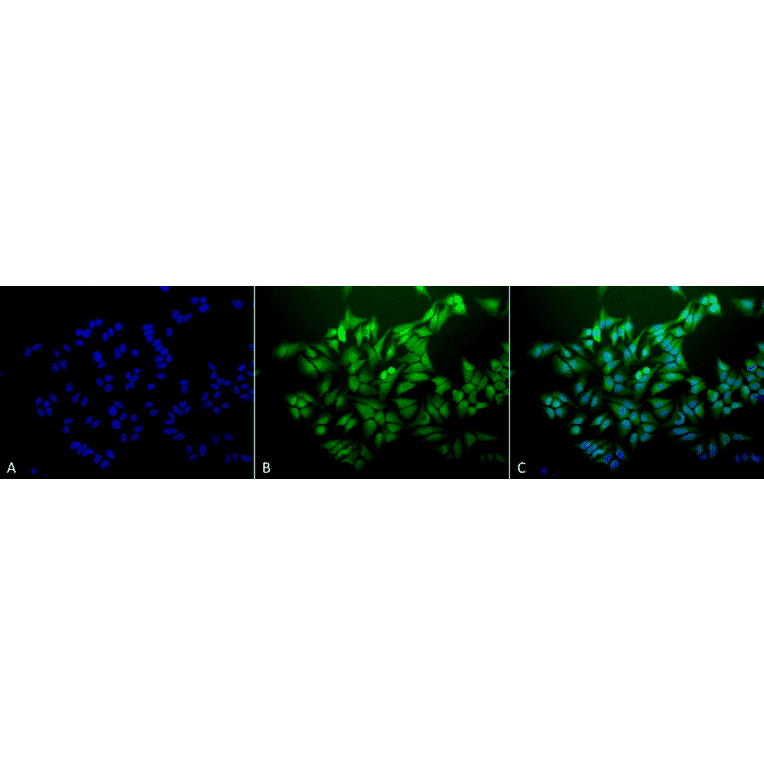 Immunocytochemistry/Immunofluorescence - Anti-Ubiquitin Antibody [6C11-B3] (A305079) - Antibodies.com