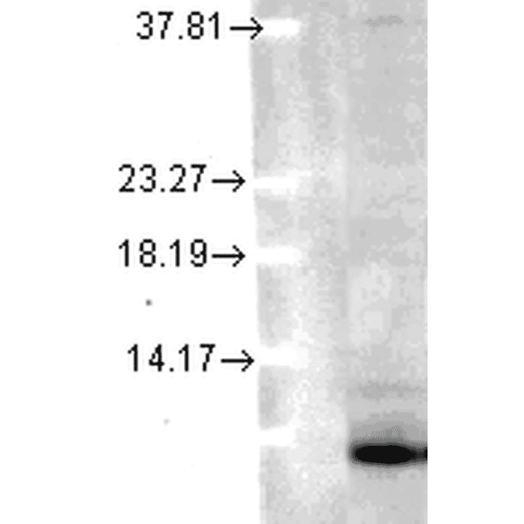 Western Blot - Anti-Ubiquitin Antibody [6C11-B3] (A305079) - Antibodies.com