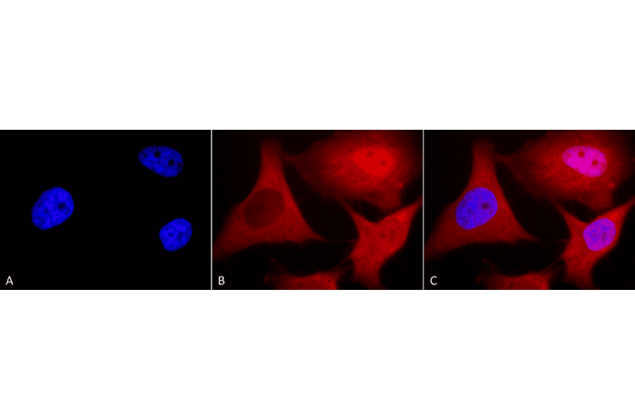 Immunocytochemistry/Immunofluorescence - Anti-Ubiquitin Antibody [6C11-B3] (A305079) - Antibodies.com