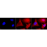 Immunocytochemistry/Immunofluorescence - Anti-Ubiquitin Antibody [6C11-B3] (A305079) - Antibodies.com