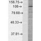 Western Blot - Anti-HIF-1 alpha Antibody [ESEE122] (A305080) - Antibodies.com