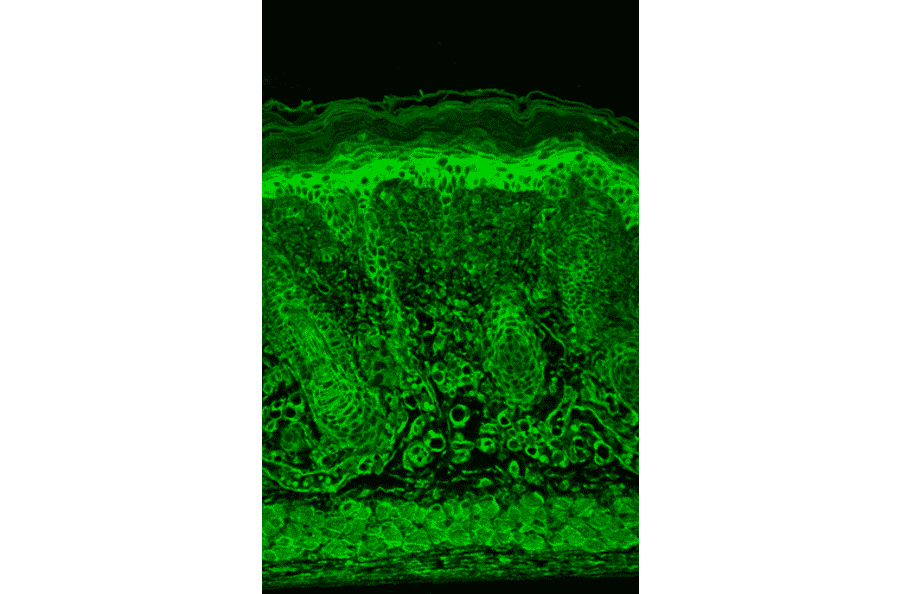 Immunohistochemistry - Anti-HIF-1 alpha Antibody [ESEE122] (A305080) - Antibodies.com