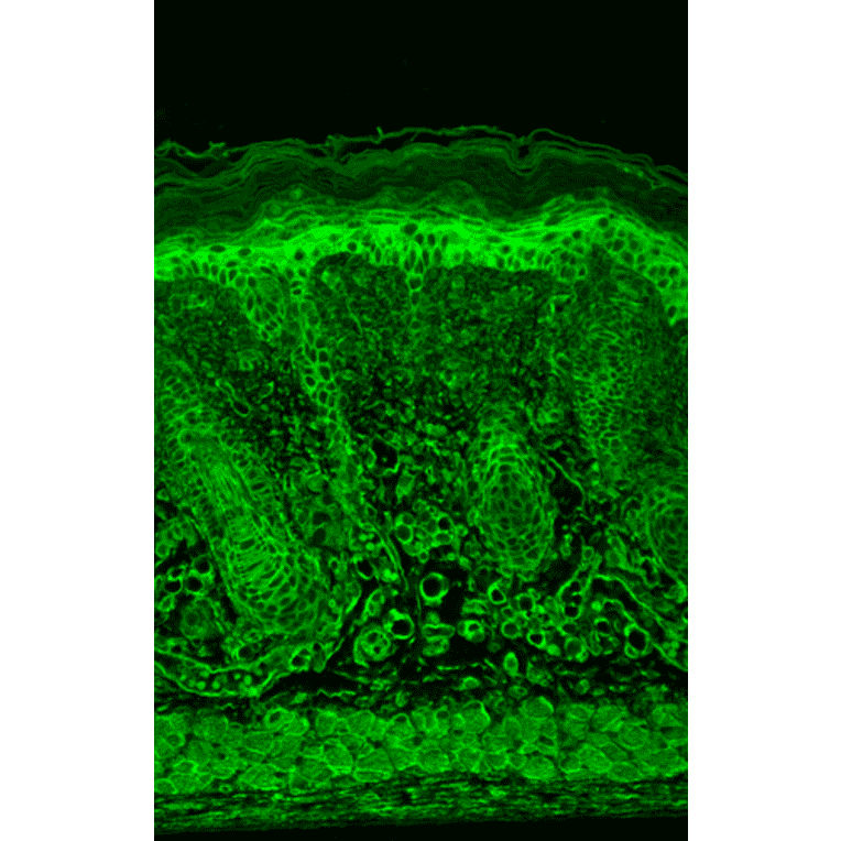 Immunohistochemistry - Anti-HIF-1 alpha Antibody [ESEE122] (A305080) - Antibodies.com