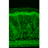 Immunohistochemistry - Anti-HIF-1 alpha Antibody [ESEE122] (A305080) - Antibodies.com