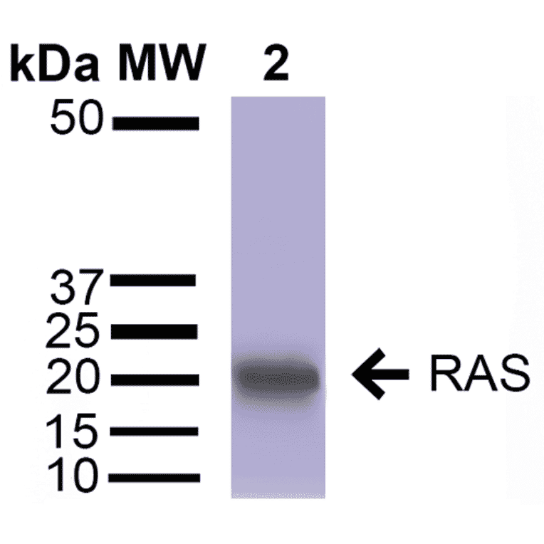 Western Blot - Anti-RAS Antibody (A305081) - Antibodies.com