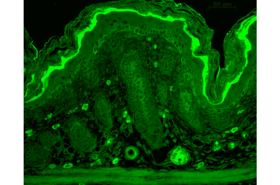 Immunohistochemistry - Anti-RAS Antibody (A305081) - Antibodies.com