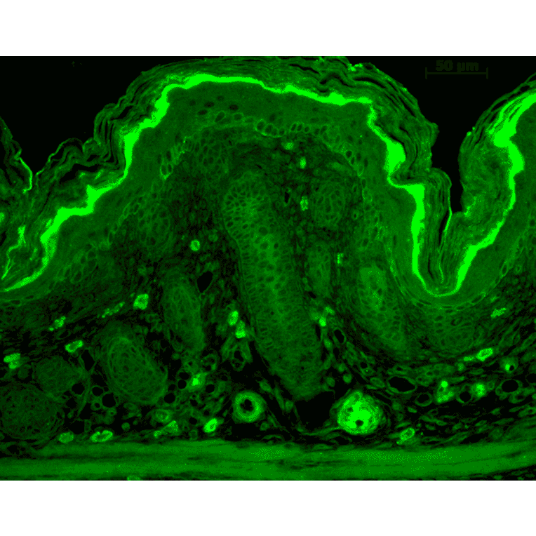 Immunohistochemistry - Anti-RAS Antibody (A305081) - Antibodies.com