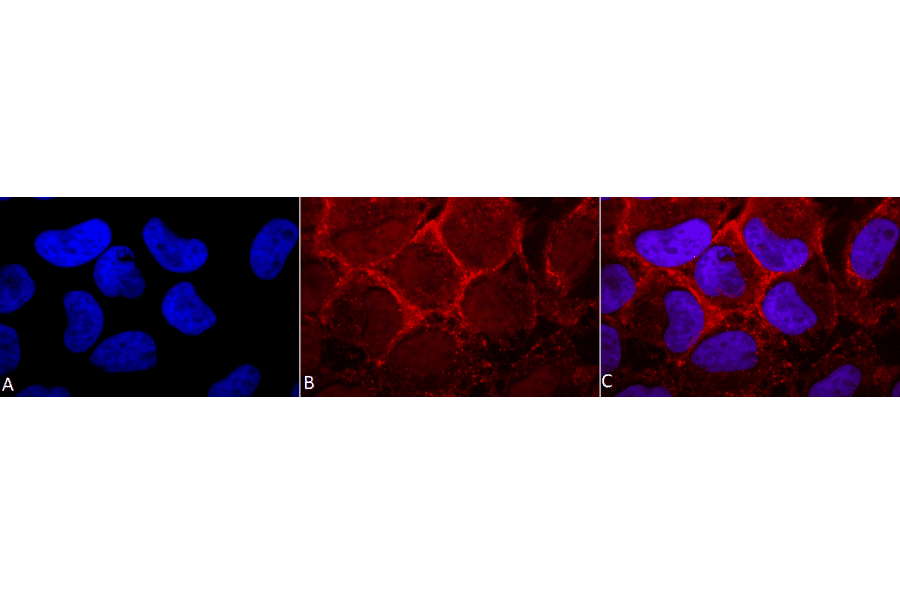 Immunocytochemistry/Immunofluorescence - Anti-RAS Antibody (A305081) - Antibodies.com