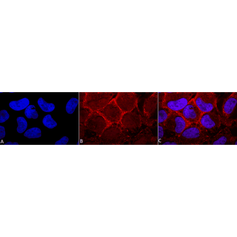 Immunocytochemistry/Immunofluorescence - Anti-RAS Antibody (A305081) - Antibodies.com