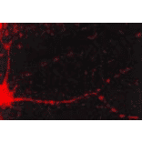 Immunocytochemistry/Immunofluorescence - Anti-CaMKII alpha Antibody [6G9] (A305083) - Antibodies.com