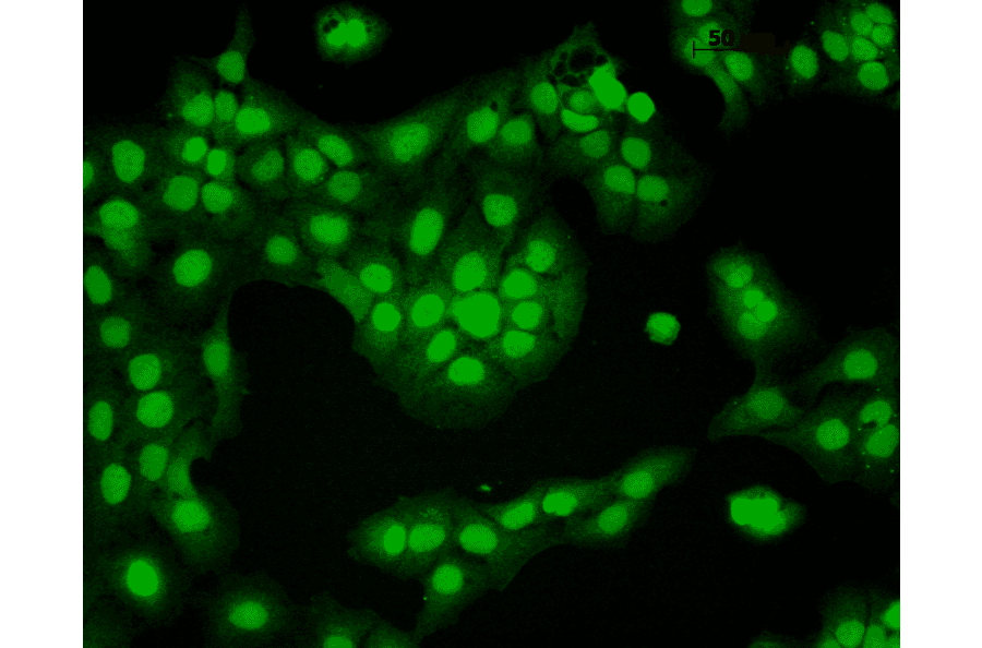Immunocytochemistry/Immunofluorescence - Anti-CaMKII alpha Antibody [6G9] (A305083) - Antibodies.com