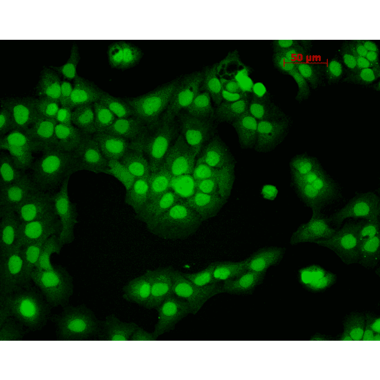 Immunocytochemistry/Immunofluorescence - Anti-CaMKII alpha Antibody [6G9] (A305083) - Antibodies.com
