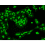 Immunocytochemistry/Immunofluorescence - Anti-CaMKII alpha Antibody [6G9] (A305083) - Antibodies.com