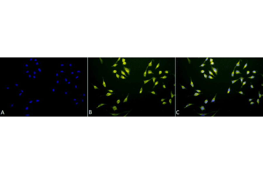 Immunocytochemistry/Immunofluorescence - Anti-P70 S6 Kinase beta / SRK Antibody (A305084) - Antibodies.com