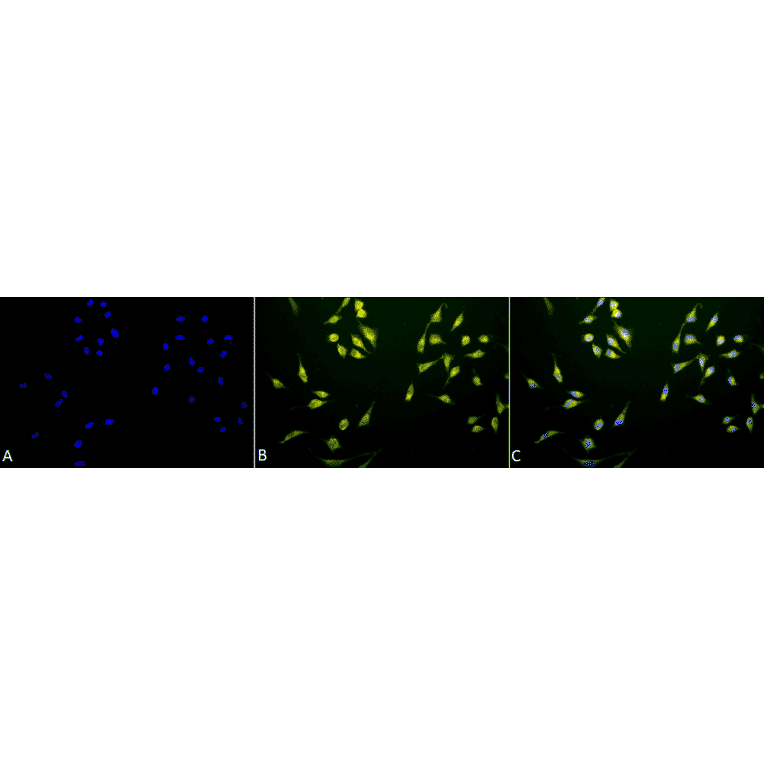 Immunocytochemistry/Immunofluorescence - Anti-P70 S6 Kinase beta / SRK Antibody (A305084) - Antibodies.com