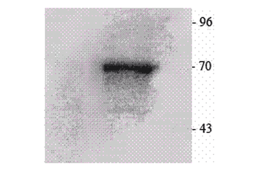 Western Blot - Anti-P70 S6 Kinase beta / SRK Antibody (A305084) - Antibodies.com