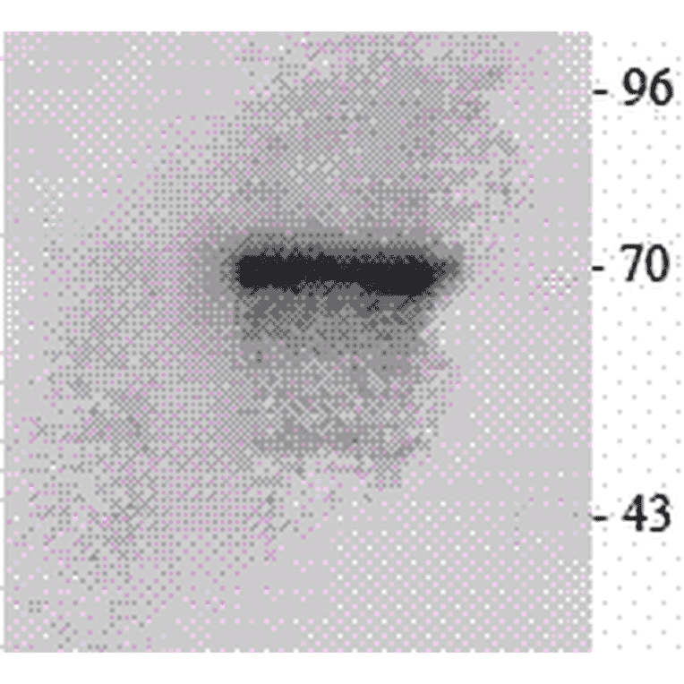Western Blot - Anti-P70 S6 Kinase beta / SRK Antibody (A305084) - Antibodies.com