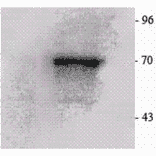 Western Blot - Anti-P70 S6 Kinase beta / SRK Antibody (A305084) - Antibodies.com