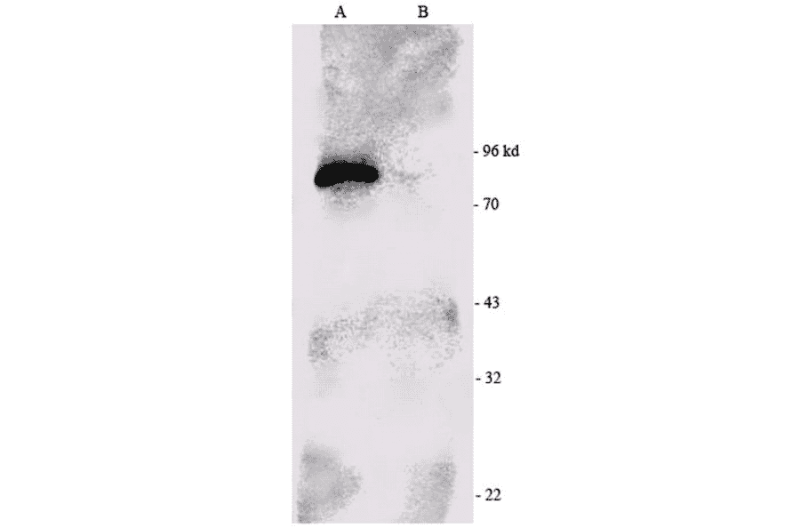 Western Blot - Anti-RSK1 p90 Antibody (A305085) - Antibodies.com