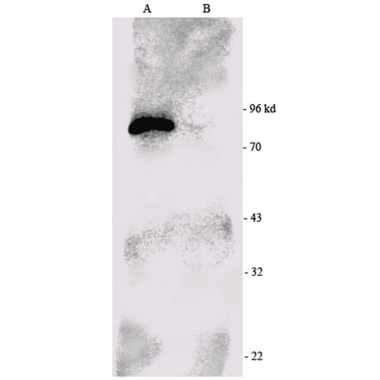 Western Blot - Anti-RSK1 p90 Antibody (A305085) - Antibodies.com