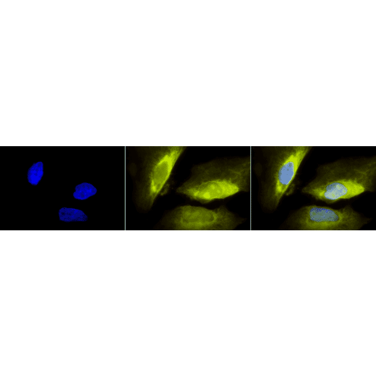 Immunocytochemistry/Immunofluorescence - Anti-RSK1 p90 Antibody (A305085) - Antibodies.com