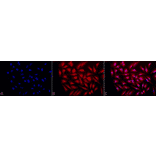 Immunocytochemistry/Immunofluorescence - Anti-GRP94 Antibody (A305086) - Antibodies.com