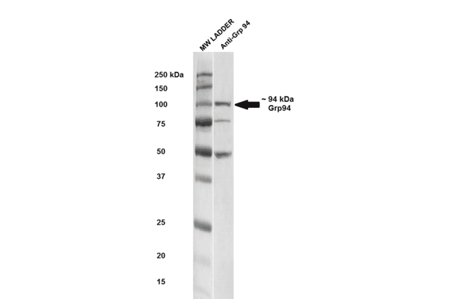 Western Blot - Anti-GRP94 Antibody (A305086) - Antibodies.com