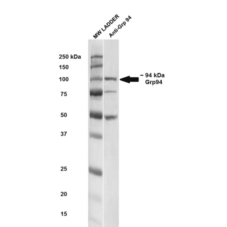 Western Blot - Anti-GRP94 Antibody (A305086) - Antibodies.com