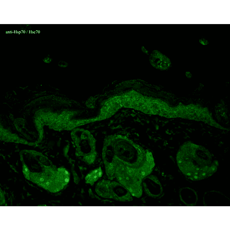 Immunohistochemistry - Anti-HSP70 Antibody [N27F3-4] (A305087) - Antibodies.com