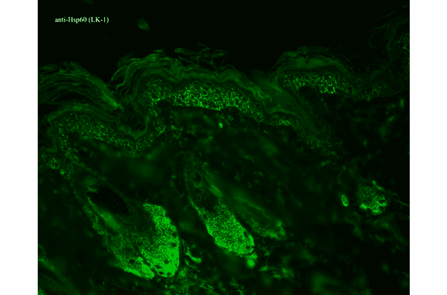 Immunohistochemistry - Anti-HSP60 Antibody [LK1] (A305088) - Antibodies.com