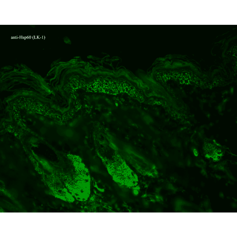 Immunohistochemistry - Anti-HSP60 Antibody [LK1] (A305088) - Antibodies.com