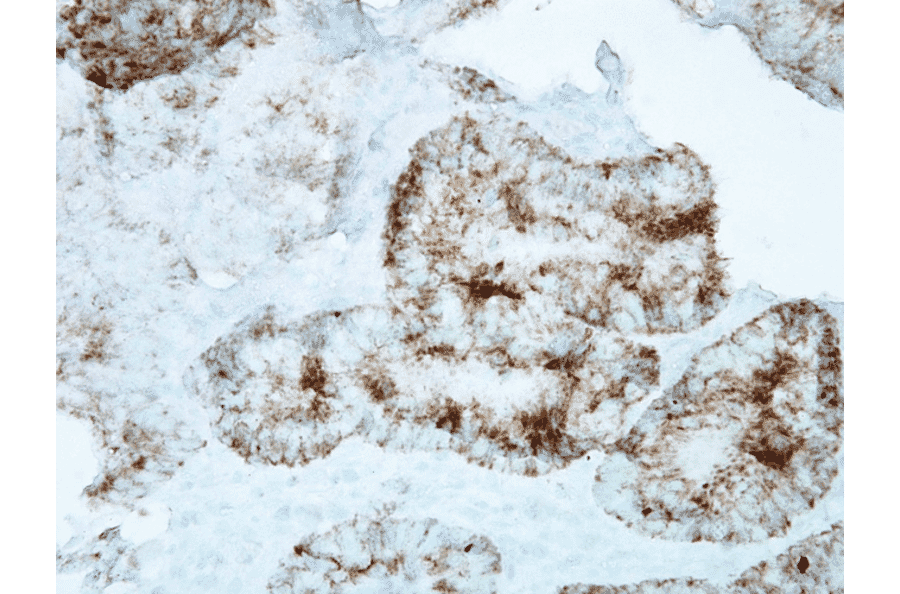 Immunohistochemistry - Anti-HSP60 Antibody [LK1] (A305088) - Antibodies.com