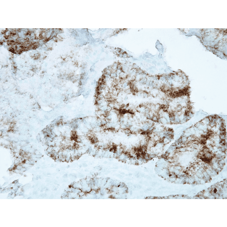 Immunohistochemistry - Anti-HSP60 Antibody [LK1] (A305088) - Antibodies.com
