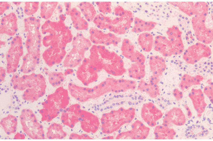 Immunohistochemistry - Anti-HSP60 Antibody [LK2] (A305090) - Antibodies.com