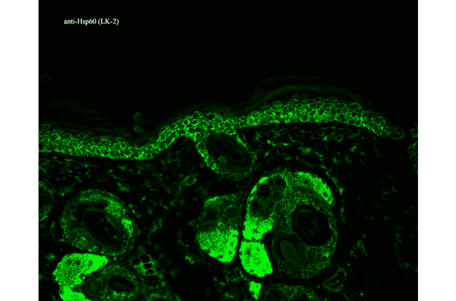 Immunohistochemistry - Anti-HSP60 Antibody [LK2] (A305090) - Antibodies.com