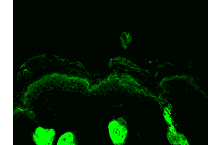 Immunohistochemistry - Anti-Calreticulin Antibody (A305091) - Antibodies.com
