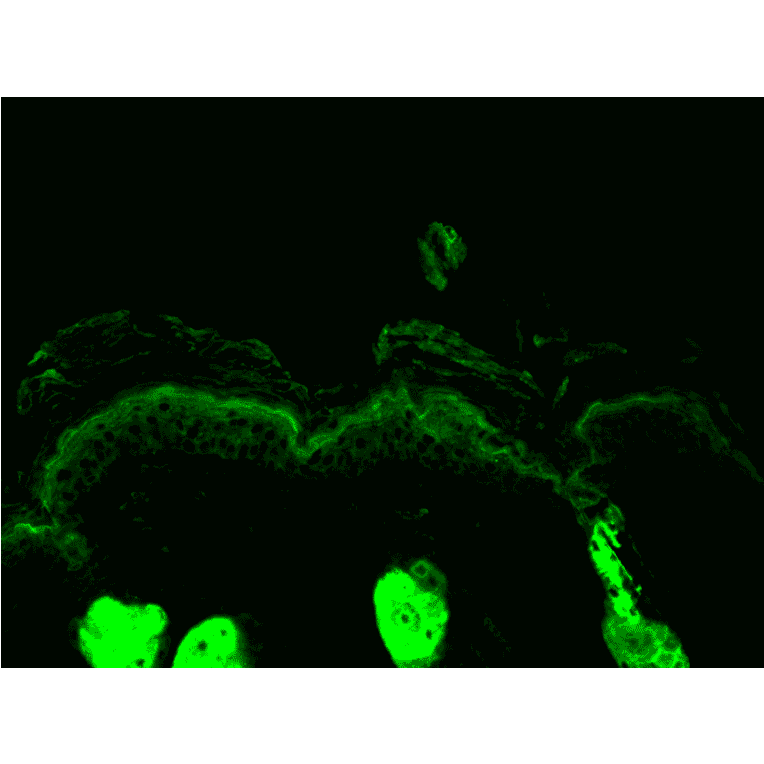 Immunohistochemistry - Anti-Calreticulin Antibody (A305091) - Antibodies.com