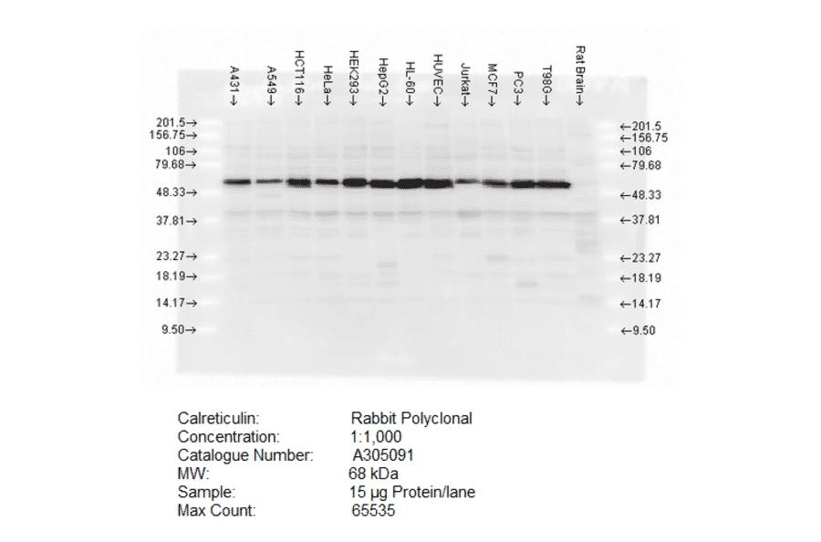 Western Blot - Anti-Calreticulin Antibody (A305091) - Antibodies.com