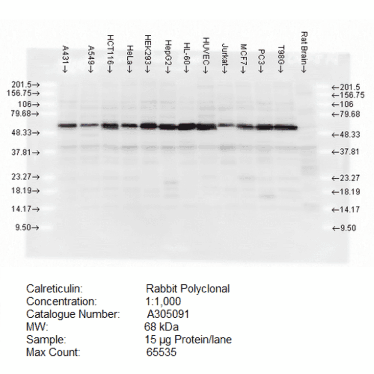 Western Blot - Anti-Calreticulin Antibody (A305091) - Antibodies.com